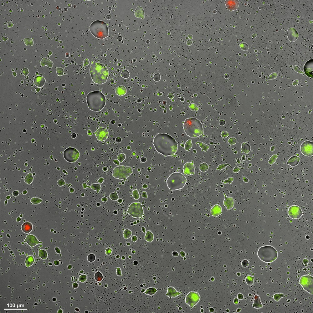 bacterial-aggregation-in-droplets.jpg