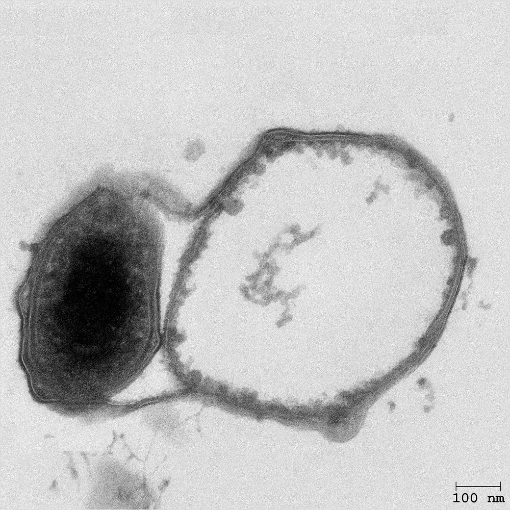 bacterial-predator-between-membranes-of-an-empty-prey-cell.jpg